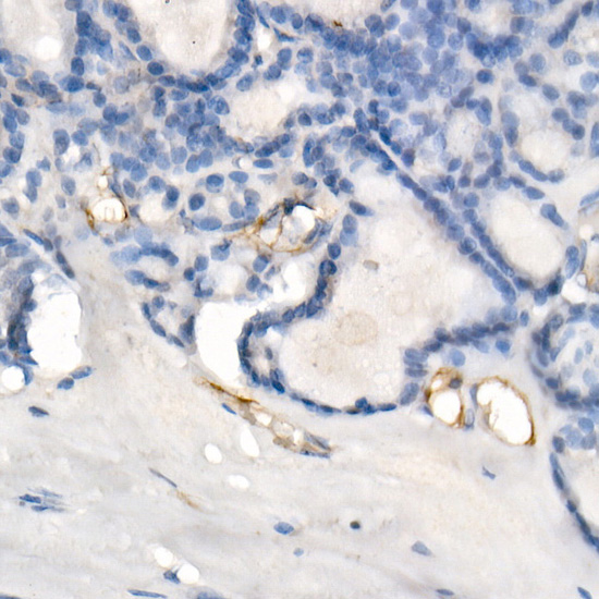 eNOS Rabbit monoclonal antibody