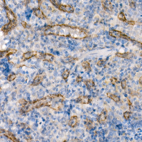 eNOS Rabbit monoclonal antibody