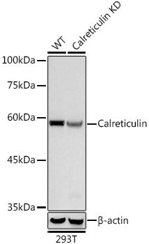 [KO Validated] Calreticulin Rabbit monoclonal antibody