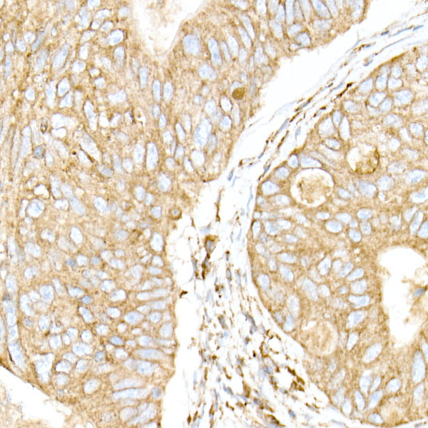 [KO Validated] Calreticulin Rabbit monoclonal antibody