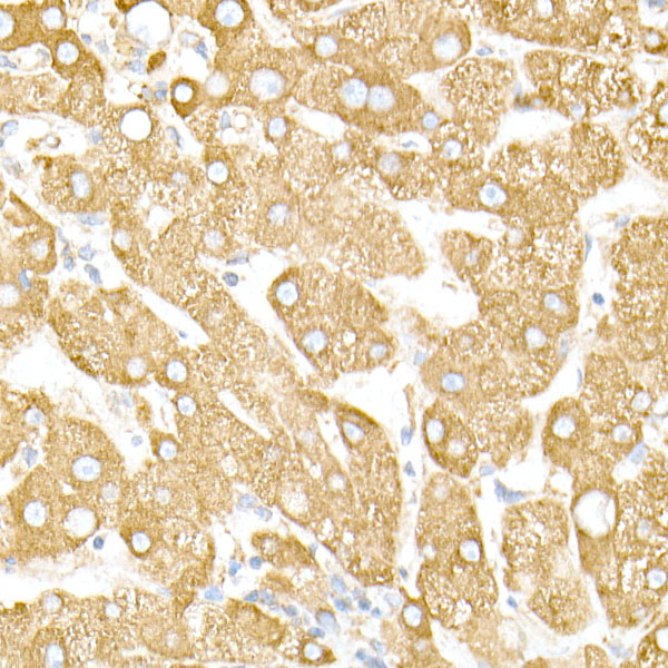 [KO Validated] Calreticulin Rabbit monoclonal antibody