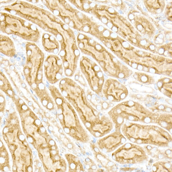 [KO Validated] Calreticulin Rabbit monoclonal antibody