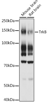 TrkB Rabbit polyclonal antibody