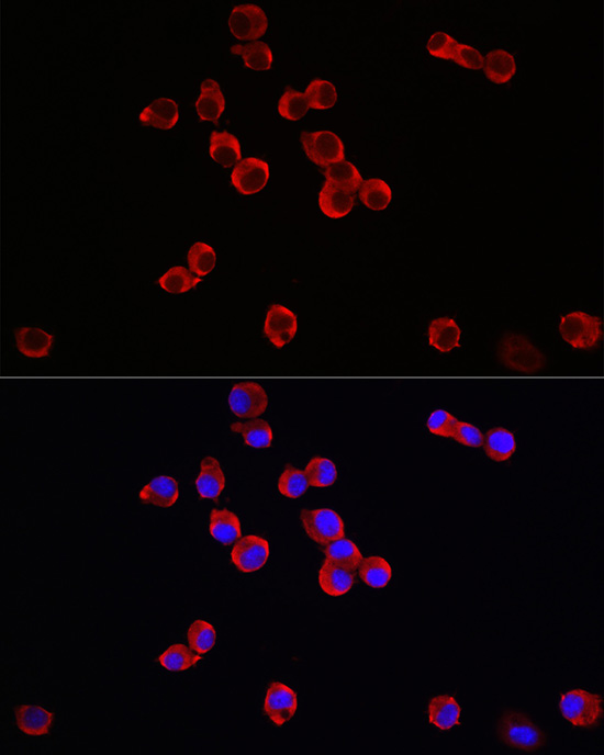 TrkB Rabbit polyclonal antibody
