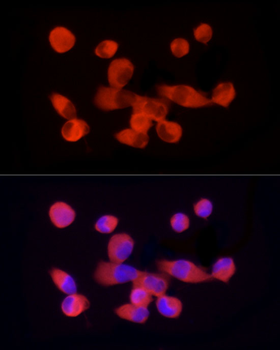 PKM2-specific Rabbit monoclonal antibody