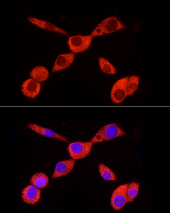 PKM2-specific Rabbit monoclonal antibody