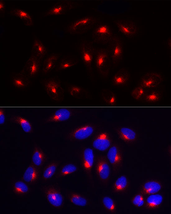 RAB11A/B Rabbit monoclonal antibody