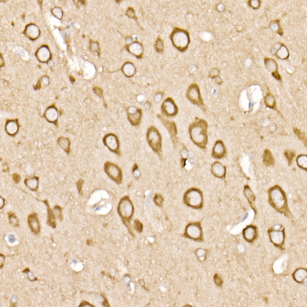 RAB11A/B Rabbit monoclonal antibody