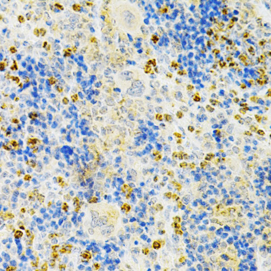 TNFRSF11B Rabbit polyclonal antibody