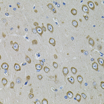 PDE1B Rabbit polyclonal antibody