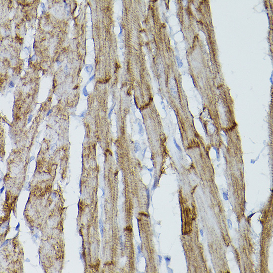 PDGFR alpha Rabbit polyclonal antibody