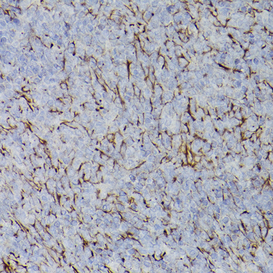PDGFR alpha Rabbit polyclonal antibody