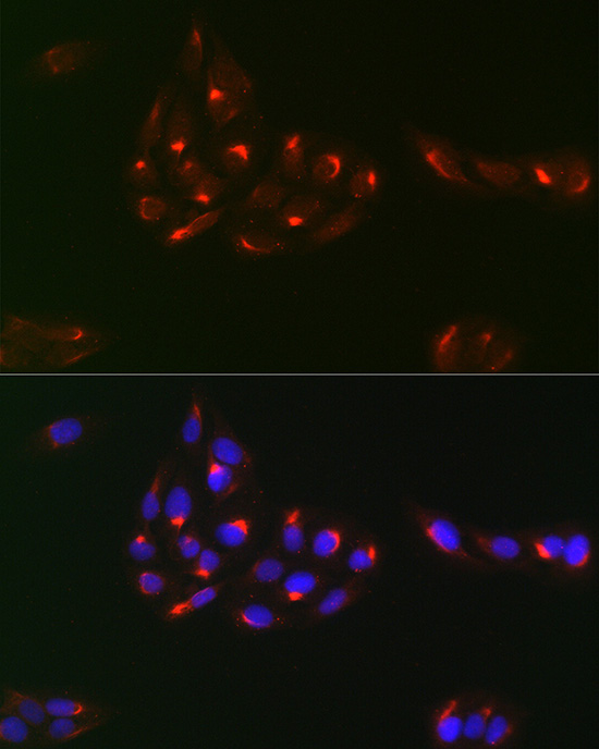 PDGFR alpha Rabbit polyclonal antibody