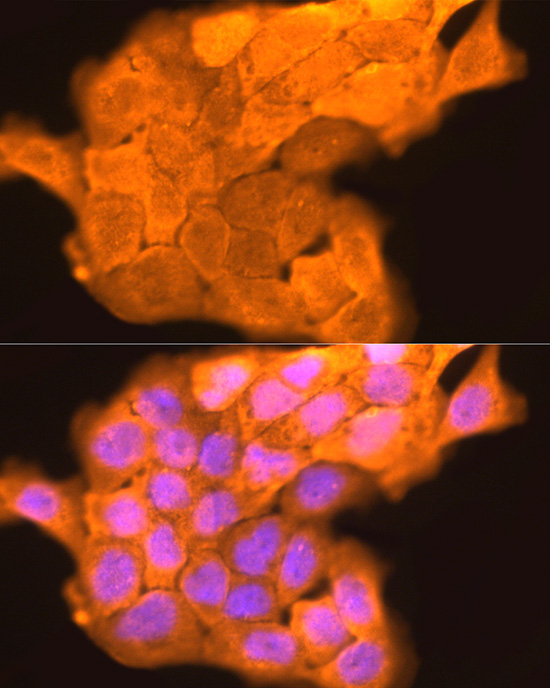 LORICRIN Rabbit polyclonal antibody