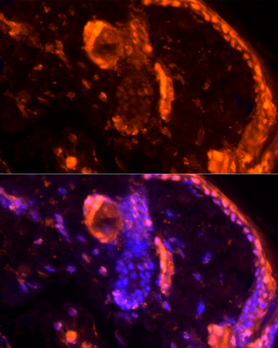 LORICRIN Rabbit polyclonal antibody
