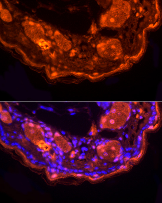 LORICRIN Rabbit polyclonal antibody
