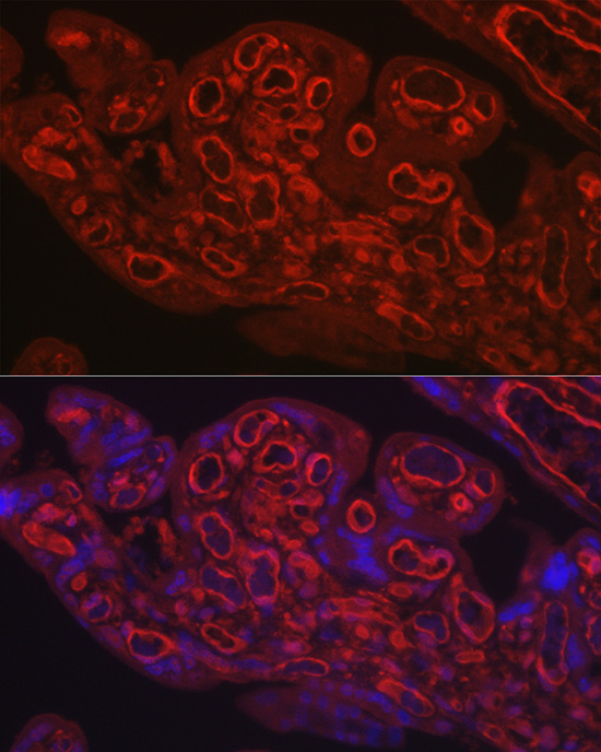 CD31/PECAM1 Rabbit polyclonal antibody