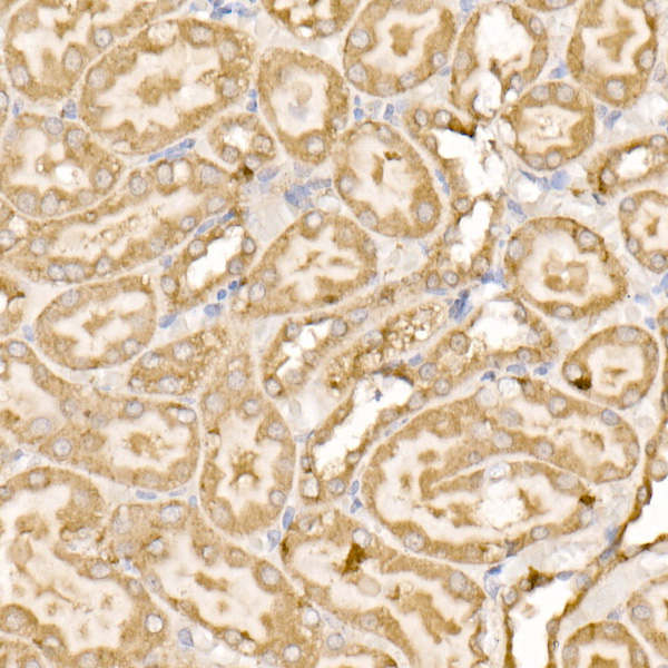 SDHC Rabbit polyclonal antibody