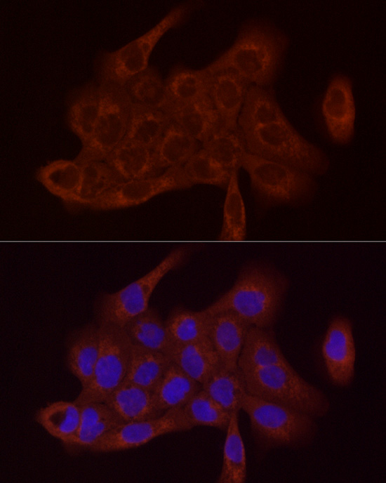 SDHC Rabbit polyclonal antibody