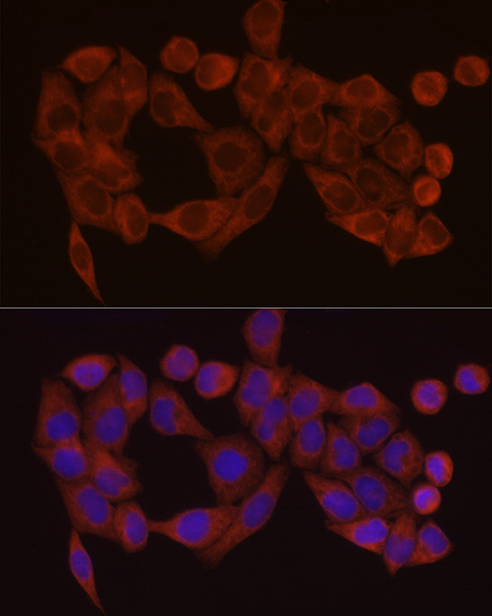 SDHC Rabbit polyclonal antibody