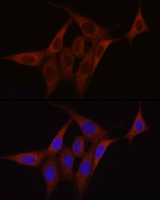 SDHC Rabbit polyclonal antibody