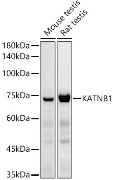 KATNB1 Rabbit polyclonal antibody