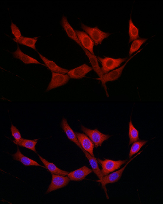 KATNB1 Rabbit polyclonal antibody