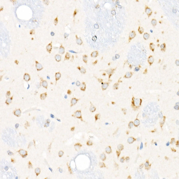 Cation-independent M6PR (IGF2R) Rabbit monoclonal antibody