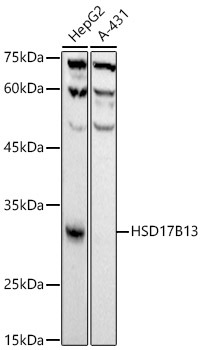 HSD17B13 Rabbit mAb