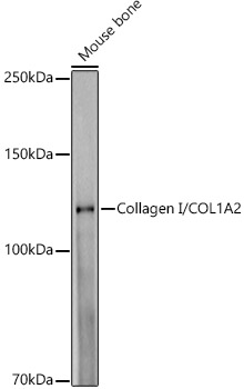Collagen I/COL1A2 Rabbit mAb