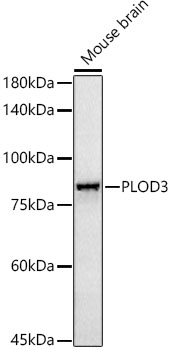PLOD3 Rabbit monoclonal antibody