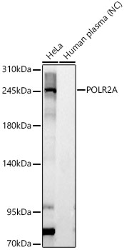 POLR2A Rabbit polyclonal antibody