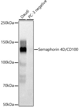 Western blot analysis of various lysates using Semaphorin 4D / CD100 Rabbit mAb (A21070) at 1:1000 dilution.<br/>Secondary antibody: HRP Goat Anti-Rabbit IgG (H+L) (AS014) at 1:10000 dilution.<br/>Lysates/proteins: 25μg per lane.<br/>Blocking buffer: 3% nonfat dry milk in TBST.<br/>Detection: ECL Basic Kit (RM00020).<br/>Exposure time: 1s.