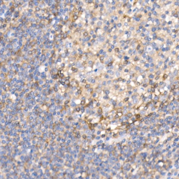 Semaphorin 4D / CD100 Rabbit monoclonal antibody