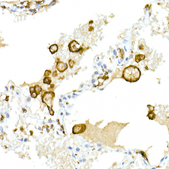 CD32A + CD32B + CD32C Rabbit monoclonal antibody