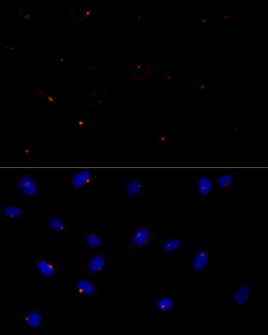 CEP43 Rabbit monoclonal antibody