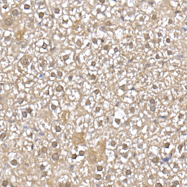 SFT Rabbit monoclonal antibody