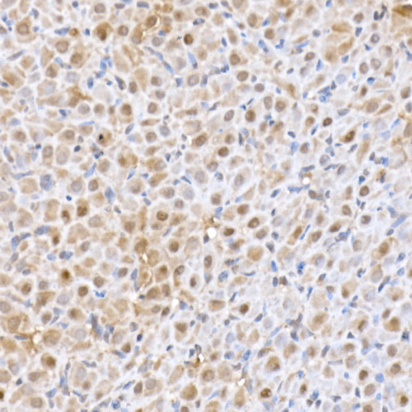 SFT Rabbit monoclonal antibody
