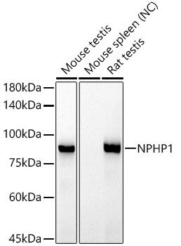 NPHP1 Rabbit monoclonal antibody