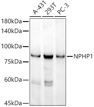 NPHP1 Rabbit monoclonal antibody