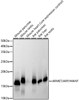 Western blot analysis of various lysates using ARMET/ARP/MANF Rabbit mAb (A21080) at1:1000 dilution.<br/>Secondary antibody: HRP Goat Anti-Rabbit IgG (H+L) (AS014) at 1:10000 dilution.<br/>Lysates/proteins: 25μg per lane.<br/>Blocking buffer: 3% nonfat dry milk in TBST.<br/>Detection: ECL Basic Kit (RM00020).<br/>Exposure time: 30s.