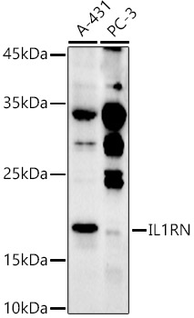 IL1RN Rabbit polyclonal antibody