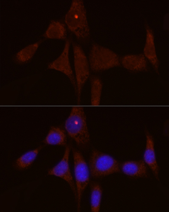 IL1RN Rabbit polyclonal antibody