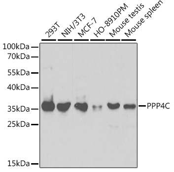 PPP4C Rabbit polyclonal antibody