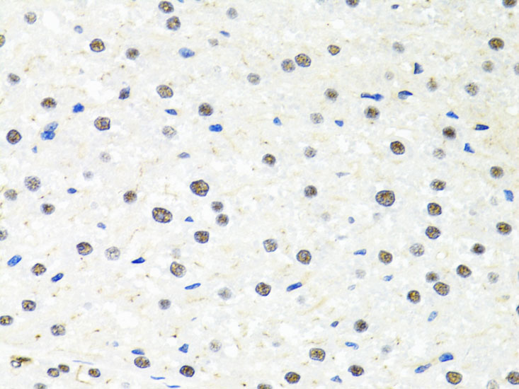 PPP4C Rabbit polyclonal antibody