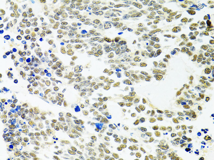 PPP4C Rabbit polyclonal antibody