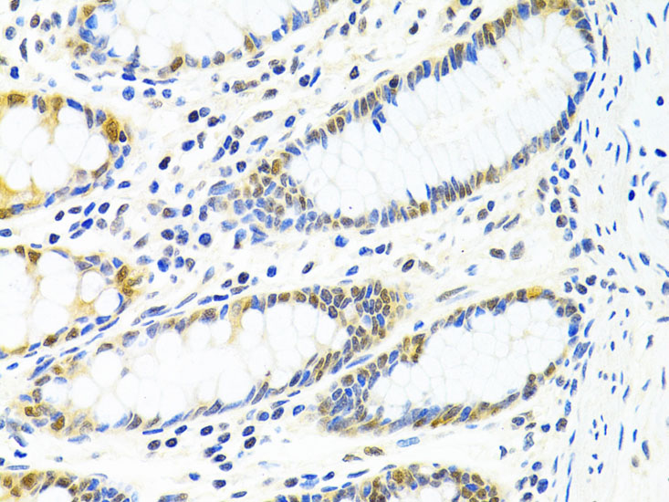 PPP4C Rabbit polyclonal antibody