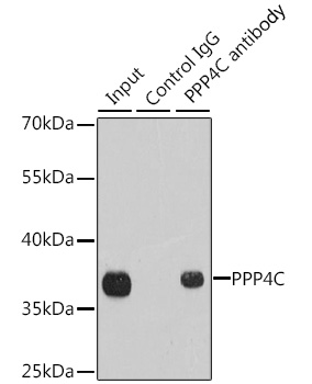 PPP4C Rabbit polyclonal antibody