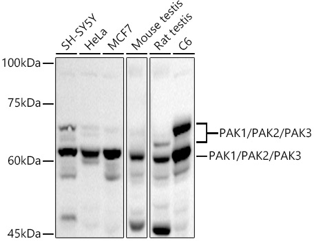 Western blot analysis of various lysates using PAK1/PAK2/PAK3 Rabbit pAb (A21090) at 1:1000 dilution.<br/>Secondary antibody: HRP Goat Anti-Rabbit IgG (H+L) (AS014) at 1:10000 dilution.<br/>Lysates/proteins: 25μg per lane.<br/>Blocking buffer: 3% nonfat dry milk in TBST.<br/>Detection: ECL Basic Kit (RM00020).<br/>Exposure time: 30s.