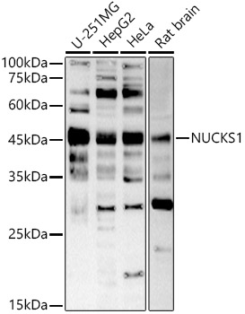 NUCKS1 Rabbit polyclonal antibody